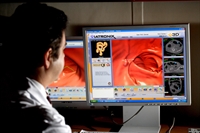 Limit colorectal screening in the elderly?