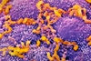 H. pylori in the stool vs. the blood