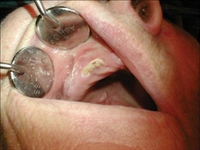 The links between oral and systemic health