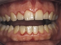 The links between oral and systemic health