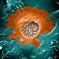 essay on chlamydia essay on chlamydia