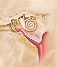 Chronic dysfunction of the eustachian tube