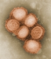 Influenza A (H1N1)