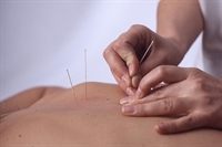 Pain relief with acupuncture is unaffected by needle location or penetration