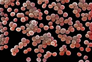 Clumps of methicillin-resistant Staphylococcus aureus bacteria Clumps of methicillin-resistant Staphylococcus aureus bacteria