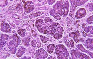 Excess iron is stored in the liver, heart, and pancreas (cross-section shown here) Excess iron is stored in the liver, heart, and pancreas (cross-section shown here)