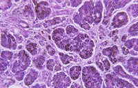 Excess iron is stored in the liver, heart, and pancreas (cross-section shown here)