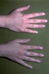 Colloidal silver—science or fraud?