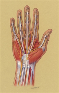 In carpal tunnel syndrome, the median nerve is compressed in the carpal tunnel of the wrist.