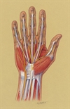 Carpal tunnel syndrome