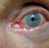 Reminders of sun exposure