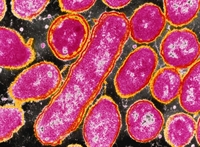 The immune response to vaccine against Hemophilus influenzae may be blunted