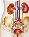 Managing UTIs in debilitated patients
