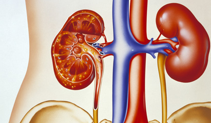 Managing UTIs in debilitated patients
