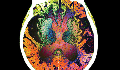 Alzheimer's management  from diagnosis to late stage