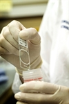 HPV cotest affects cervical cancer screening