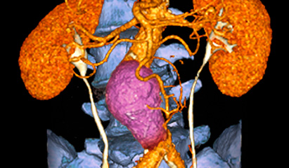 Imaging options for patients with acute abdominal pain