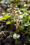 An effective natural remedy for migraine and allergies