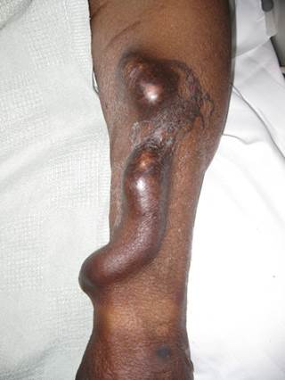 Cost of dialysis in new zealand cost of turning into a dialysis technician