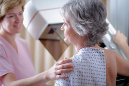 Mammography accuracy in cancer survivors