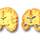 Brain tissue loss Brain tissue loss