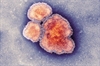 Measles, Mumps & Rubella