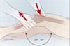 Tests to assess ACL rupture