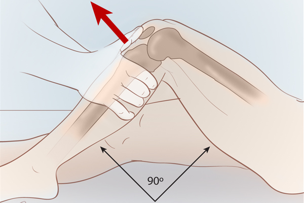 sports activities physical remedy