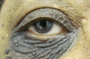 Discoloration of the eyelid