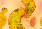 Practice antibiotic stewardship to preserve benefits Practice antibiotic stewardship to preserve benefits