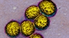 Updated information  on MRSA infections