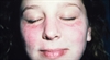 Lupus and the autoimmune process in 2012