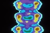 "Predisease": A concept whose time has come?