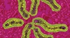 Helicobacter pylori: Toward effective eradication
