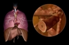 Anatomy of an Asthma Attack