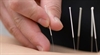 Acupuncture improved dyspnea on exertion in COPD