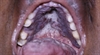 Oral involvement of ­systemic diseases