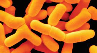 Probiotics ease antibiotic GI side effect Probiotics ease antibiotic GI side effect