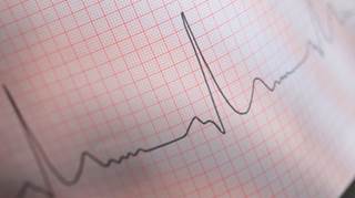 Recommended tests poorly utilized in hypertensive teens Recommended tests poorly utilized in hypertensive teens