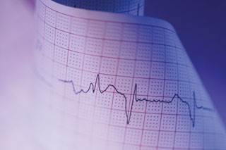 Task force still says "no" to ECG screening Task force still says "no" to ECG screening