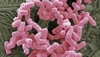 Managing UTIs in women