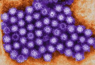 CDC: Novel norovirus replacing former dominant strain CDC: Novel norovirus replacing former dominant strain