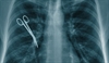 Surgical 'never events' occur at least 4,000 times annually