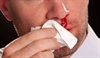 Should fatty liver be considered in spontaneous bleeding?