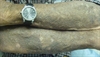 Blue discoloration on both arms and legs