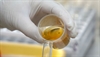 Quantifying proteinuria 