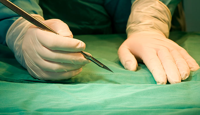Mt. Sinai surgeon removes wrong kidney