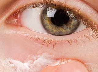 Steroid cream for eyelid dermatitis