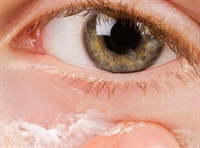 Safe Periocular Steroid Use For Eyelid Dermatitis - The Clinical Advisor