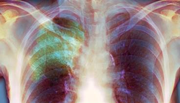 Stat Consult: Upper-respiratory infection Stat Consult: Upper-respiratory infection